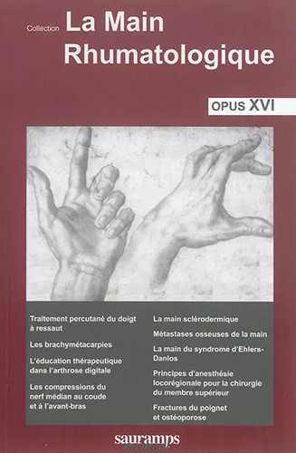 Main rhumatologique opus - la,