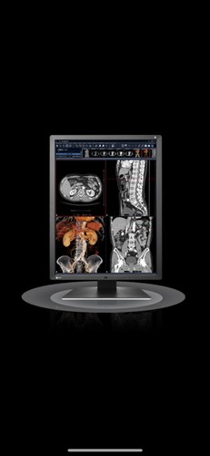 Eizo radiforce rx250 - rx250, 21.3-inch