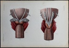 1866 - Prostate et vésicules séminales - Anatomie & Urologie - Gravure ancienne
