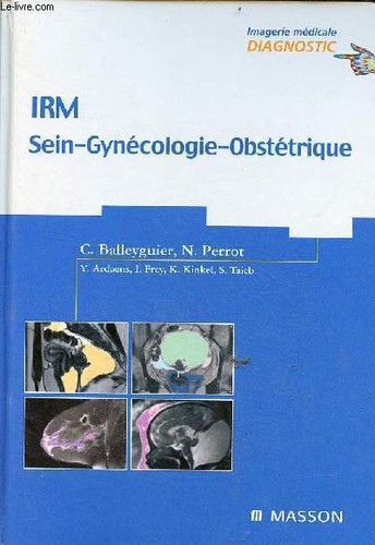 IRM