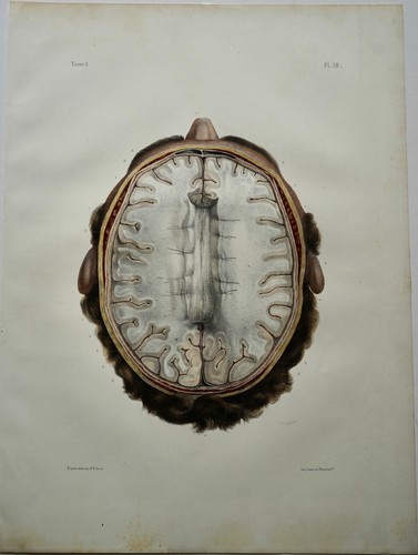 Bourgery jacob anatomie 1844 - bourgery,