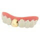 Dentier Dent Or