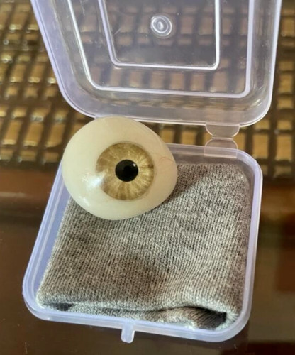 Prothèse oculaire