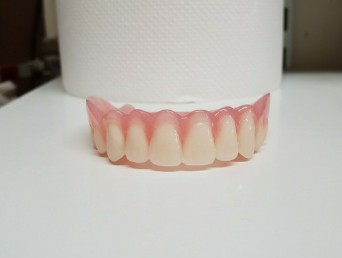 Prothèse complète