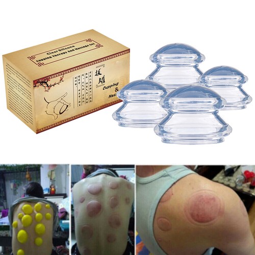 Cups silicone set massage - 4,