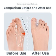 Séparateur d'orteils usure