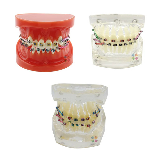 Modèle orthodontique - le,