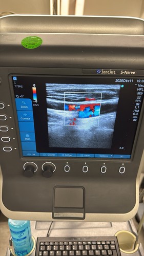 Echographe portable sonosite - echographe, s