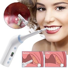 Electronic Visible Tonsil