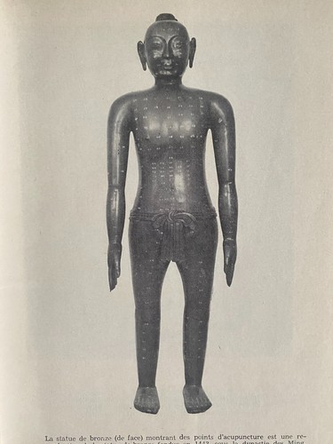 Précis acupuncture - précis, d'acupuncture