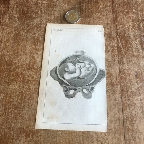 Ancienne gravure anatomie n102 - anatomie,