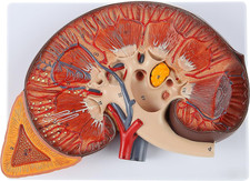 Modèle de rein humain |Le