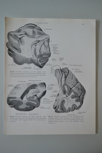 Planche anatomie humaine - planche, d'anatomie