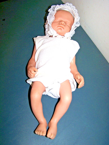 Vintage somso hospital baby - hospital,