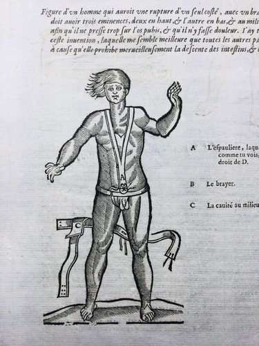 1585 prothèse pénis - 1585,