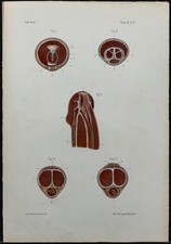 1866 - Verge & urètre - Anatomie & Urologie - Gravure ancienne