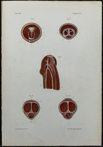 1866 verge urètre - -,