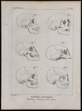 1825 - Variétés du crâne