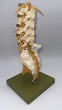 Somso QS66/1  Lumbar Vertebral