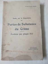 Rare : Curiosité / Pertes De