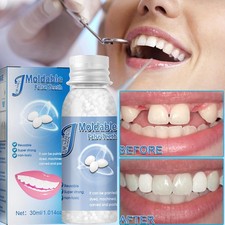 Fausse Dent Provisoire en