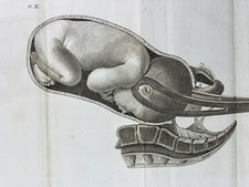 Obstétrique en 1807