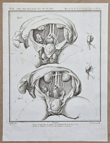 Gravure xixeme planche - xixeme,