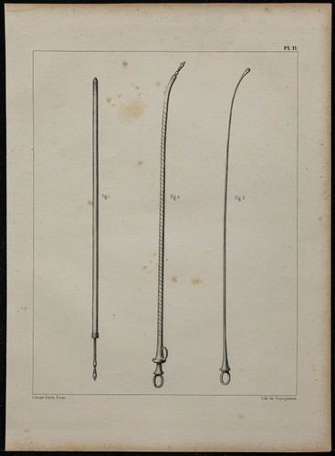 1839 planche chirurgie - -, &