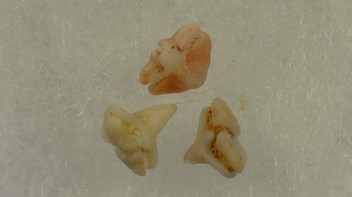 Ray tooth dents raie - ray, de