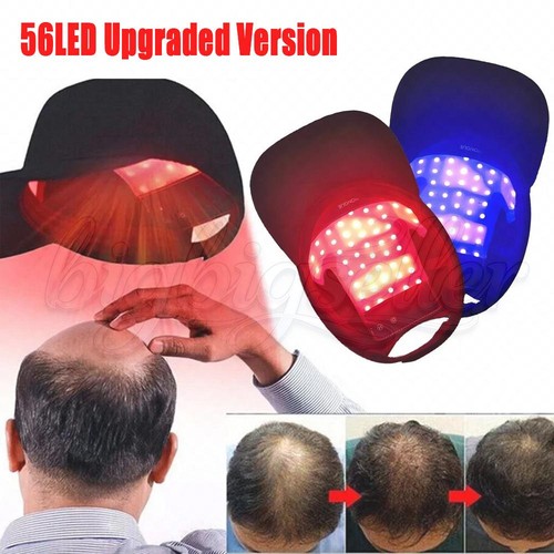 660nm red led - light, therapy