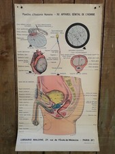 ANCIENNE AFFICHE-PLANCHES