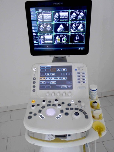 Echographe aloka hitachi - echographe,