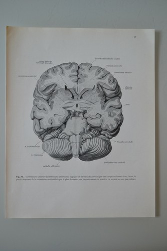 Planche anatomie humaine - planche, d'anatomie