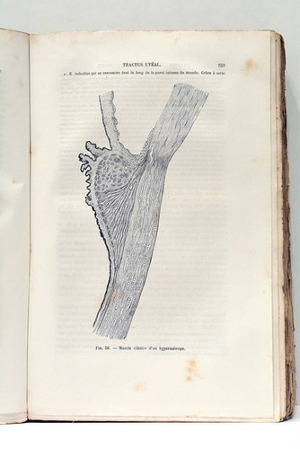 Livre ancien ophtalmologie - ancien,