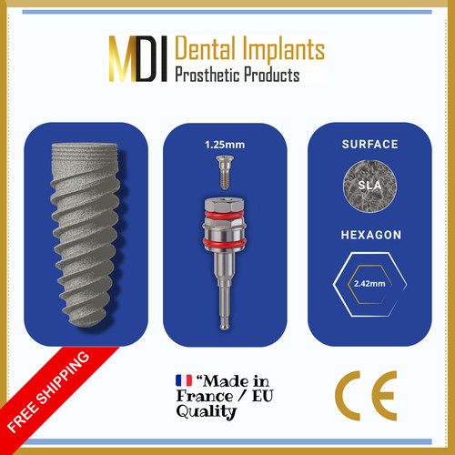 Spiral dental fixture - dental,