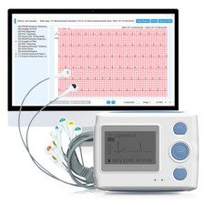 Moniteur ECG 24 heures sur 24
