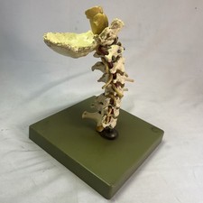 Somso Cervical Spinal Column