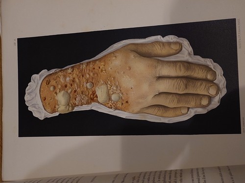 Rare musée l hôpital - de, l'hôpital