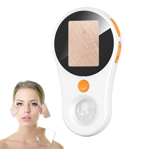 Handheld dermatoscope skin - dermatoscope,