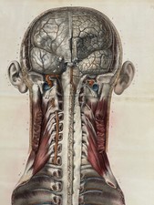 Grande planche depliable anatomie XIXème corps humain chirurgie curiosa tête