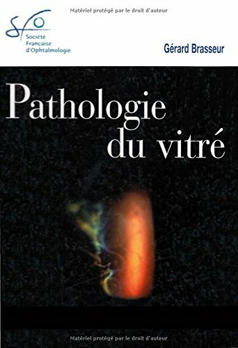 Pathologie vitré par - du,