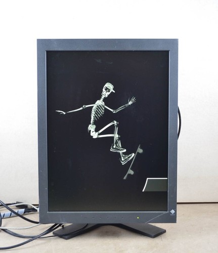 Moniteur lcd ips - lcd, médical