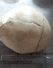 Crane humain ancien env 1900 Medecine Hydrocephale? Cabinet Reflexion.