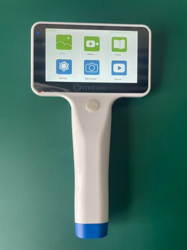 Coreray otoscope vidéo - coreray,