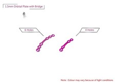 1.5mm Orbital Plaque Avec Pont