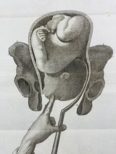 Médecin Obstétrique en 1807