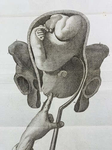 Médecin obstétrique 1807 - obstétrique, en