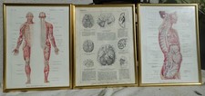 3 gravures originales