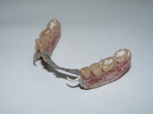 Ancien dentier prothèse