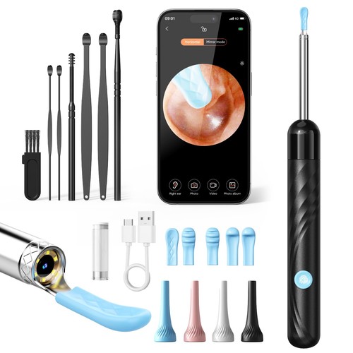 Otoscope oreille 1080p - otoscope, hd